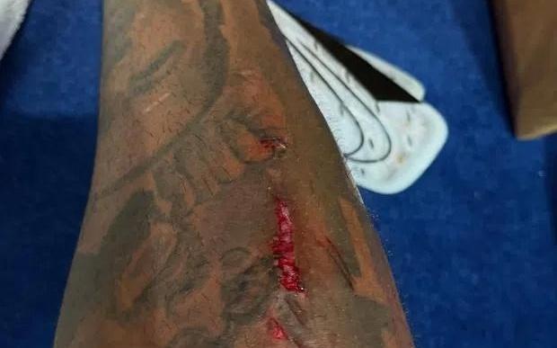 慎入,里斯詹姆斯的小腿在比赛里被划出一道血口子