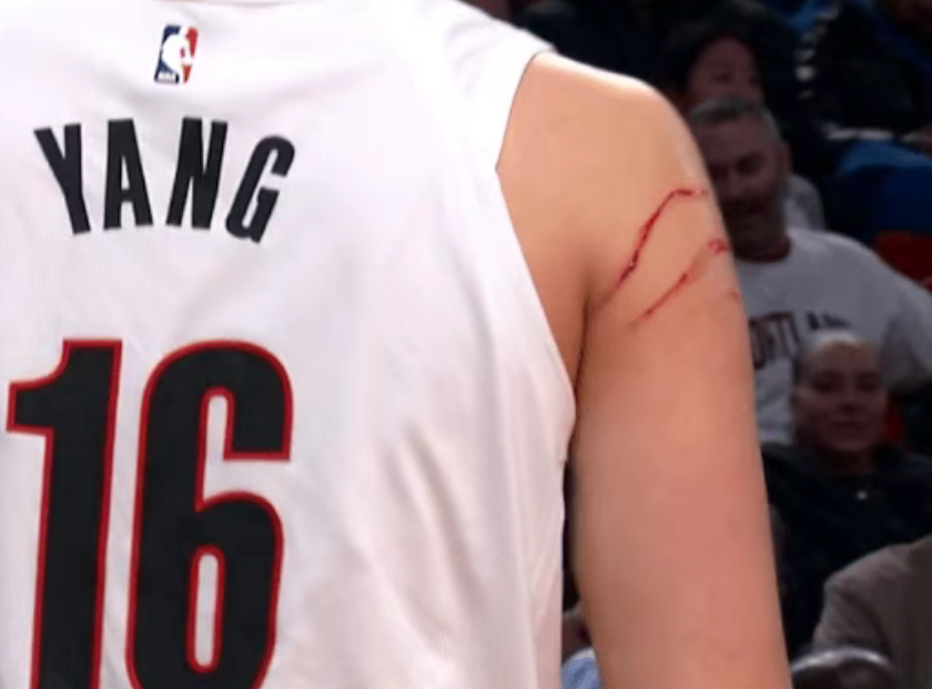 创NBA生涯纪录！杨瀚森连7战登场入轮转被抓出两道血痕引争议